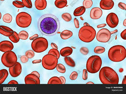 Inadequate nutrition, especially a low intake of these foods, may lead to megaloblastic anemia. Hemotransfusion Image Photo Free Trial Bigstock