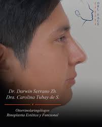 RINOPLASTIA EN HOMBRES, ---, Nuestro objetivo principal es lograr la  armonía del rostro y, a la vez, conseguir una ventilación nasal óptima.,  ---, Existe una notable diferencia entre la rinoplastia ...
