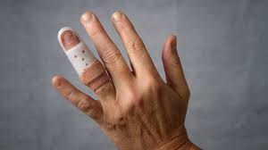 Finger Fracture Hand And Wrist