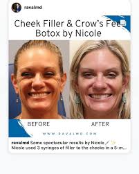 Nicole Kenyon, RN, BSN (@nkenyonrn) · Denver, CO