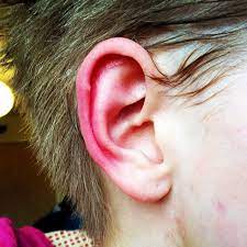 Why Are My Ears Red And Hot Siowfa16 Science In Our World Certainty And Controversy