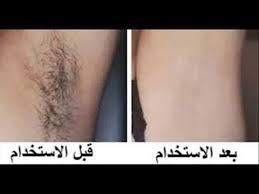 أناقة مغربية أسهل طريقة لإزالة الشعر الغير مرغوب فيه نهائيا Beauty Skin Care Routine Beauty Care Beauty Skin