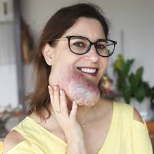 My Facial Growth Has Taught Me Self Love