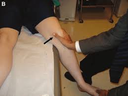 Image result for Patella Mobility Test