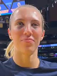 Lexie Hull injury: Two black eyes for the Indiana Fever wing