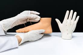 Image result for Acupuncture