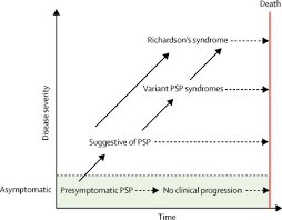 Advances In Progressive Supranuclear Palsy New Diagnostic Criteria Biomarkers And Therapeutic Approaches The Lancet Neurology