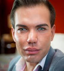 The stigma surrounding plastic surgery is disappearing as more mothers share their experiences, and why surgery was right for them. Man Who Spent 125 000 On Plastic Surgery Irish Mirror Online