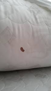 Wenn sich der bezug von matratze oder sofa abziehen lässt oder sie einen abnehmbaren schoner verwenden, ist es ganz. Blutfleck Auf Matratze Hotel Amstelzicht Amsterdam Holidaycheck Nordholland Niederlande