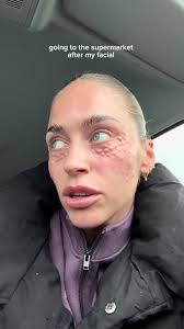 Lauren Sanchez Ex Husband Tony