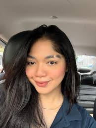 My Face Before and After 1 Week No Sugar