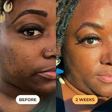 Introduction and appreciation in Monze community