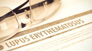Systemischer Lupus Erythematodes Sle Alles Uber Symptome Therapien Und Verlauf Onmeda De