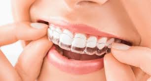 This is how long it actually takes to get abs. Transparent Teeth To Wear