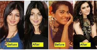 However, surgery is also an. 11 Bollywood Actresses Who Have Undergone Plastic Surgery
