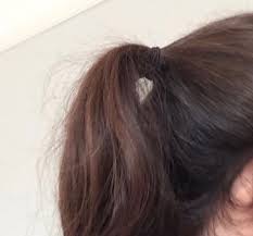 Birth control pills cause the hair to move from the growing phase to the resting phase too soon and for too long. Accutane Hair Accutane Nebenwirkungen