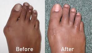 Pin On Foot Pain