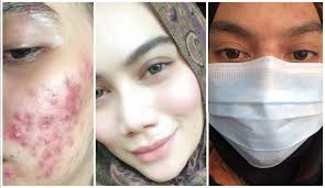 Terdapat wanita yang mengatakan mereka mencapai puncak syahwat yang lebih apabila titik g terangsang. Betullah Jodoh Itu Rahsia Allah Wanita Muka Berjerawat Tapi Baik Hati Budi Allah Balas Kahwin Dengan Anak Orang Kaya Kartel Dakwah