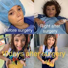 Petr korbel vs kanak jha. Appendicitis Pada Kanak Kanak Apakah Itu Dan Bagaimana Ia Boleh Dirawat Di Malaysia