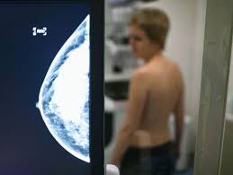 Solothurner Kantonsrat 2 75 Millionen Fur Mammografie Programm Wo Bleibt Da Der Sparwille