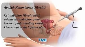 Check spelling or type a new query. Furmon Penang Tanda Tanda Fibroid Dan Cyst Dalam Rahim Facebook