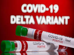Sep 03, 2021 · fauci said the mu variant, technically known as b.1.621, has mutations suggesting it would evade certain antibodies, potentially including those from vaccines. Jtzmpix3n Pbbm
