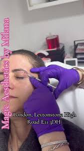 #stratford #microneedling #beauty #aesthetics #eastlondon #leytonstone  #leyton #antiag #botox #fillers #chemicalpeel #skinbooster #mesotherapy  #walthamstow #revolax #westfild #treatwell #instagram ...