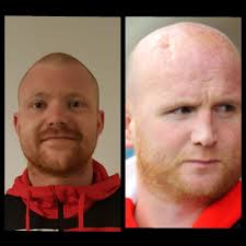 Craig Muir (craigmuir_91@)