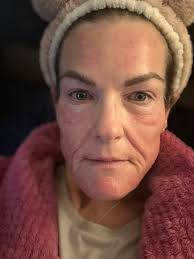 Detox mask uses other than armpits?