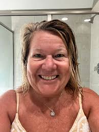 🌟 WOW, 20 days in and I'm absolutely amazed by the transformation! 🌟  Check out the pics! My forehead wrinkles are becoming a thing of the past!  And I wanted to get