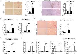 Weitere ideen zu gladbach, vfl borussia mönchengladbach, vfl borussia. Il 4 Receptor Alpha Signaling Through Macrophages Differentially Regulates Liver Fibrosis Progression And Reversal Ebiomedicine