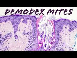 Image result for Demodex brevis