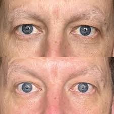 Favorite eye cream for youthful eyes and hair growth tricks?