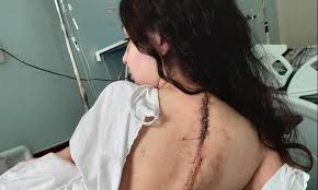 Com muita dor, informo a vocês que mabel hoje teve morte cerebral. Internada Com Doenca Rara Mabel Calzolari Mostra Cicatriz De 9Âª Cirurgia Creio Que Tudo Vai Ficar Bem Jornal O Globo