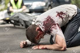 In addition to mental and emotional anguish, car accident victims also may. Car Accident Victim Lying On Street With Bloody Wound Investigator And Car In The Background Stock Photo Picture And Royalty Free Image Image 56065240