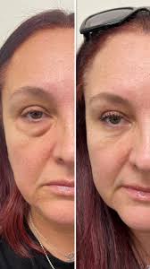 Dr. Babak Maleki, Oculoplastic Surgeon