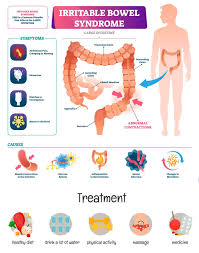 Colon cancer (colorectal cancer) and irritable bowel syndrome (ibs) have common symptoms and signs, for example, constipation, the feeling of still having to go to the bathroom after a bowel movement, and changes in bowel movements. Are You Overlooking Symptoms Of Irritable Bowel Gi Associates
