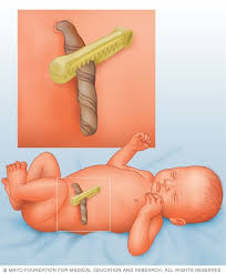 Two or three times a week is usually enough. Umbilical Cord Care Do S And Don Ts For Parents Mayo Clinic