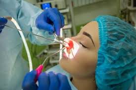 Image result for Sinus Surgery