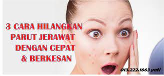 Setiap orang tentu pernah melalui fasa 'diserang' jerawat. Vitamin Yati 3 Cara Hilangkan Parut Jerawat Dengan Cepat Dan Berkesan