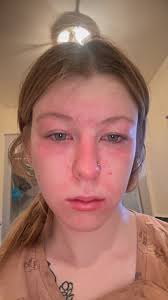 Riding in an ambulance causes motion sickness