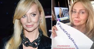 Tabloid doszedł do szokujących informacji. Agnieszka Wozniak Starak Bez Makijazu Na Instagramie Kozaczek