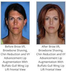 Pin On The Life Of A Facial Plastic Surgeon