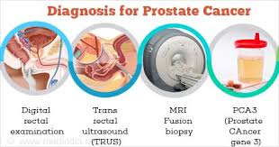 In fact, most people don't even know what it does. Prostate Cancer Cancer Of Prostate Incidence Prevention Causes Symptoms Treatment