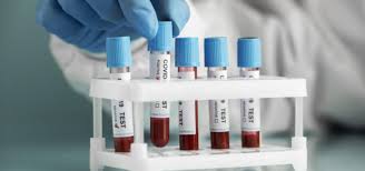 Jun 11, 2021 · la variante delta del coronavirus, dominante en el reino unido, es 60% más contagiosa que su predecesora, la alfa, afirma un estudio publicado el viernes, antes de que el gobierno anuncie su decisión sobre el levantamiento de las últimas restricciones. Coronavirus Variante Delta Espana