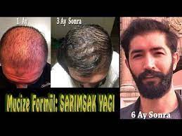 Sac Cikaran Mucize Formul 4 Sarimsak Yagi Nasil Yapilir Youtube 2021 Sac Sarimsak Youtube