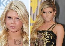 A lot of the magic happens in the mua station, where inspiration often strikes for a new look that pushes the limits to something entirely fresh and edgy. Chanel West Coast Plastic Surgery Photos Verge Campus