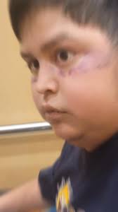 Jayden's Big Heart added a new photo.