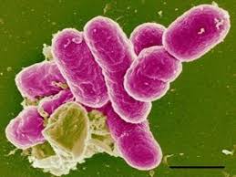 Image result for Shigella