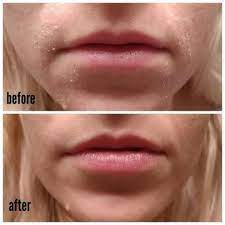 31 Things That Basically Give You No Choice But To Have Better Skin Super Dry Skin Dry Skin On Face Dry Skin Body